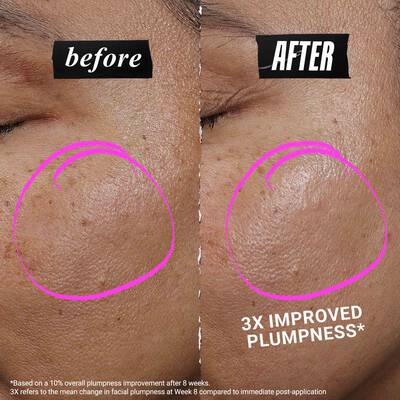 Side-by-side comparison labeled “before” and “after,” showing improved plumpness on the skin. Text reads “3x improved plumpness.”