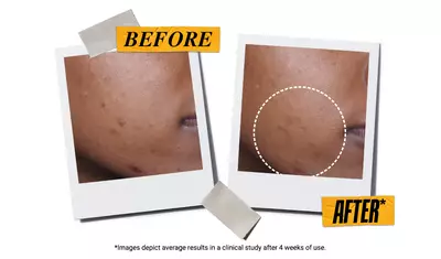 Before and after