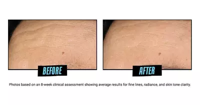 Before and After Glycolic Acid Serum