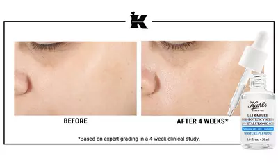 Before and After Retinol Serum