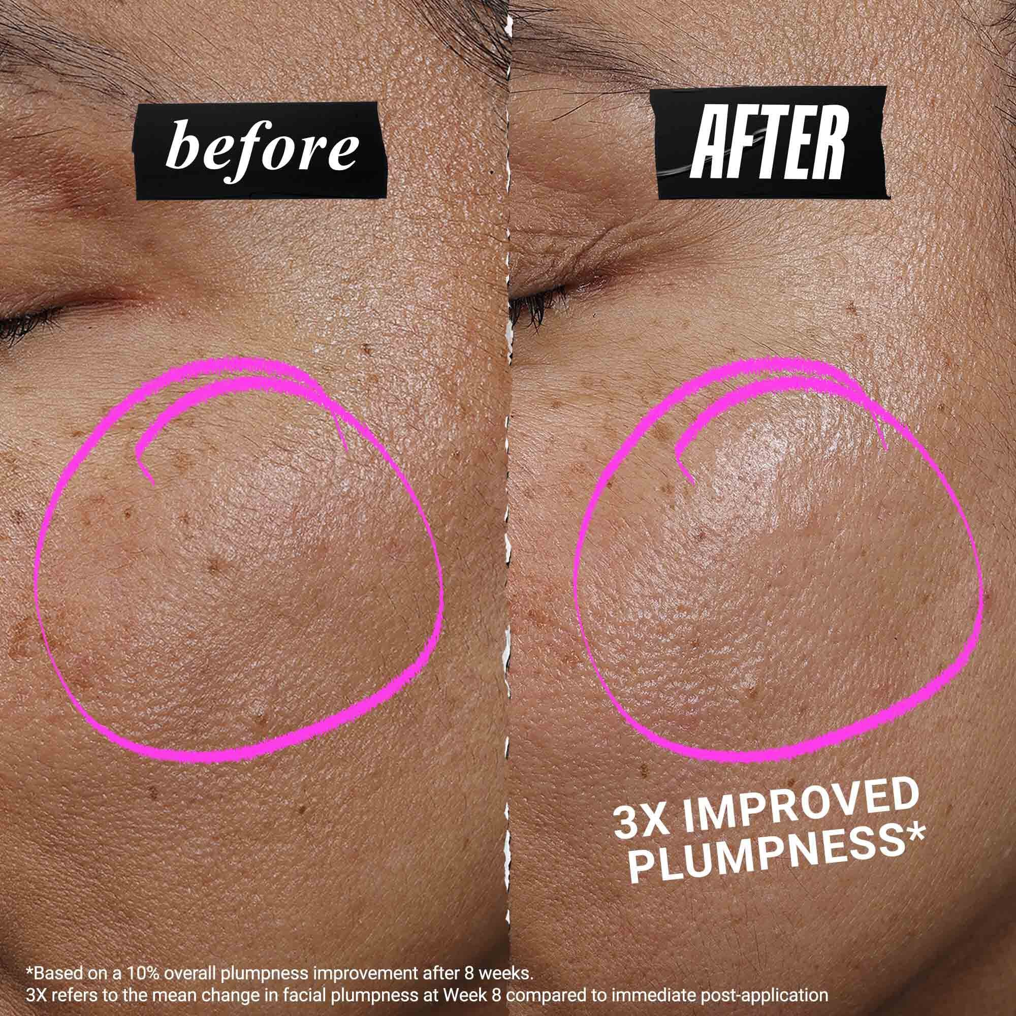 1cc* CollaShot Plump Serum