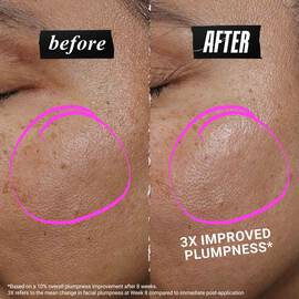 1cc* CollaShot Plump Serum