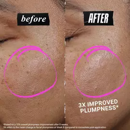 1cc* CollaShot Plump Serum