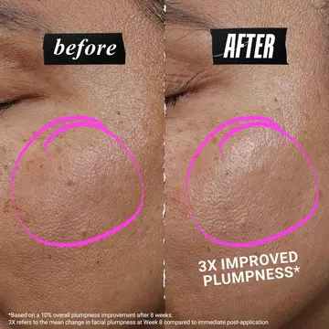 1cc* CollaShot Plump Serum