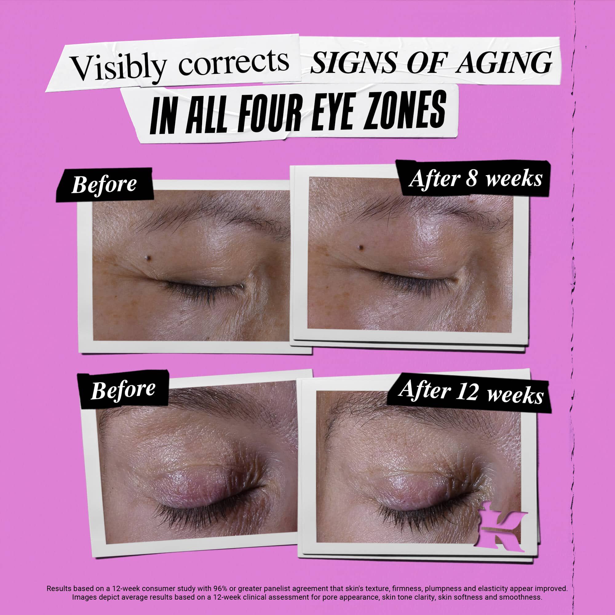 Super Multi-Corrective Eye Zone Treatment