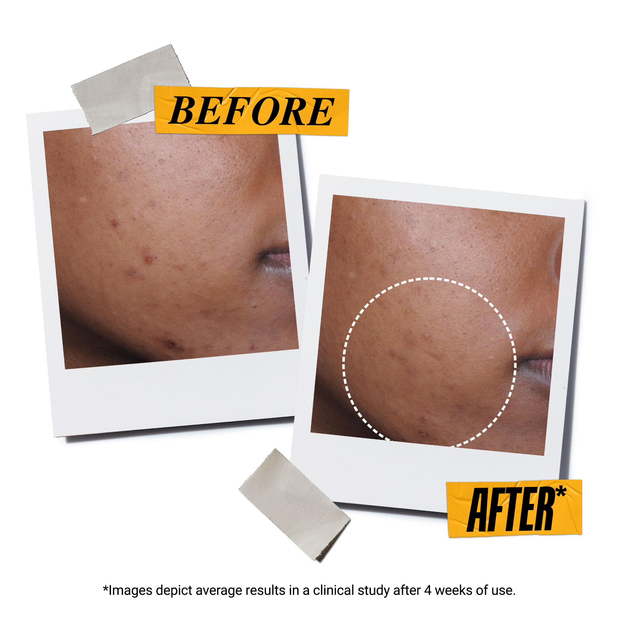 Beyond Screen® UV Serum SPF 50+ Facial Sunscreen with Collagen Peptide