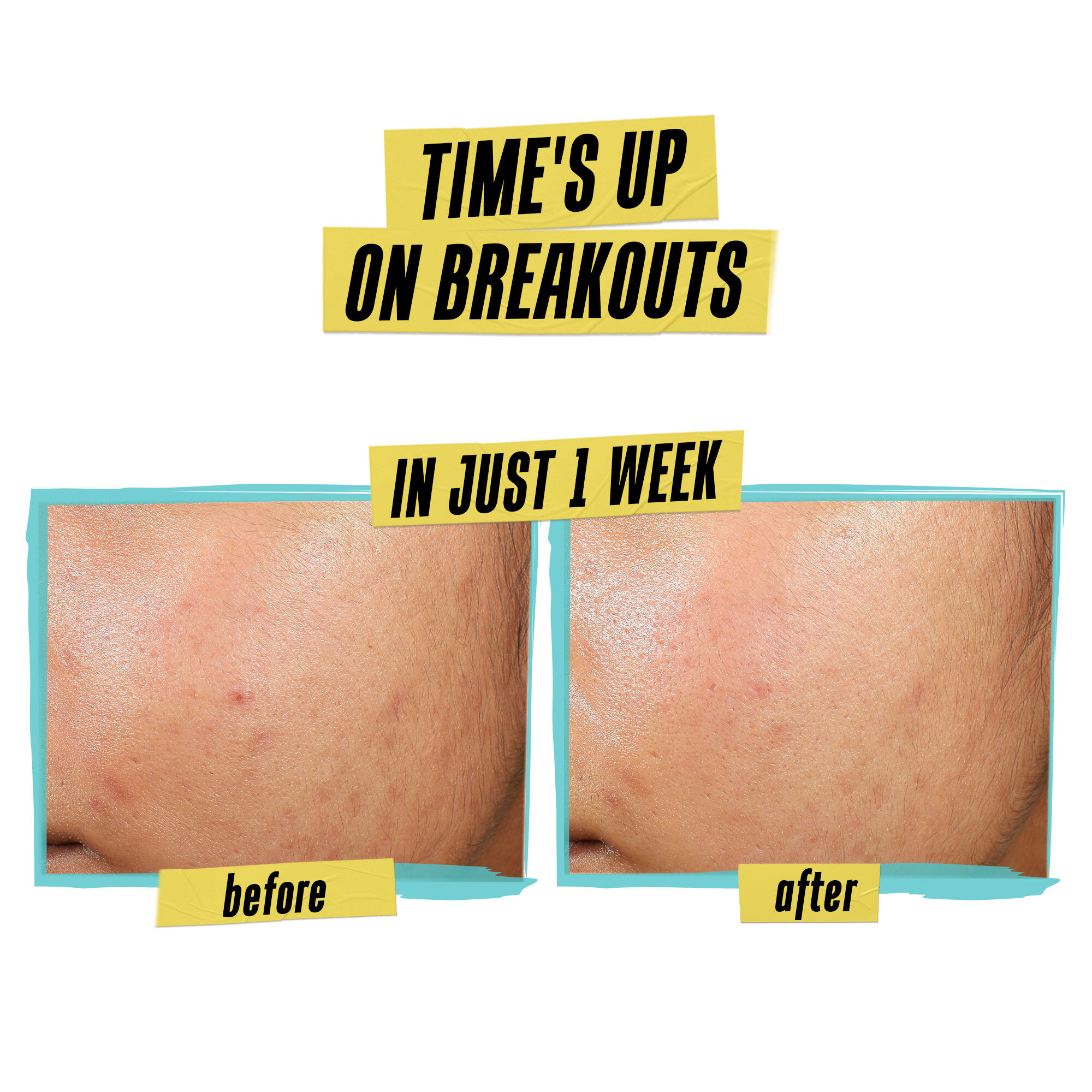 Expertly Clear Acne Lotion - Salicylic Acid - Kiehl's Canada