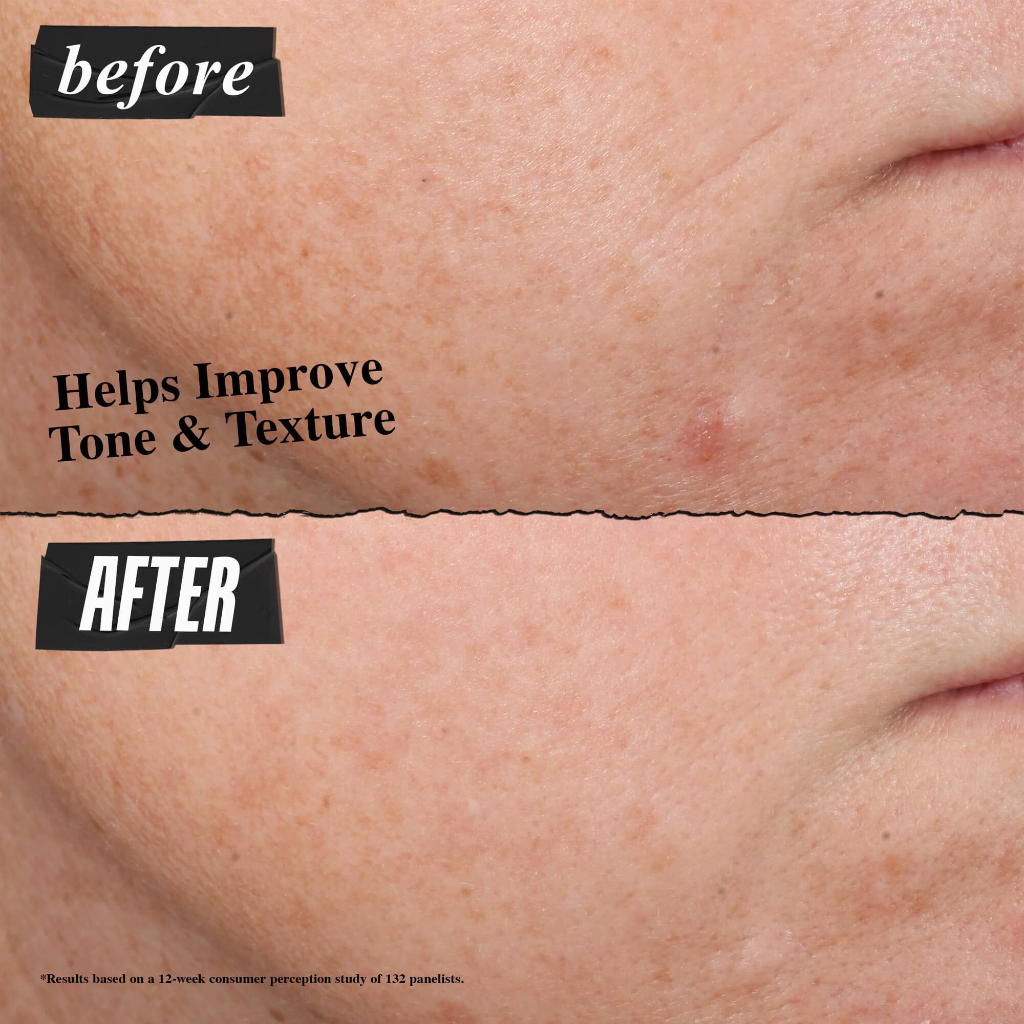 Retinol Skin-Renewing Daily Micro-Dose Serum with Ceramides and Peptide