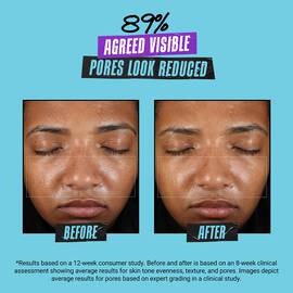 Creme super multi-corrective creme douce sans huile