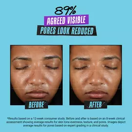 Super Multi-Corrective Oil-Free Soft Cream