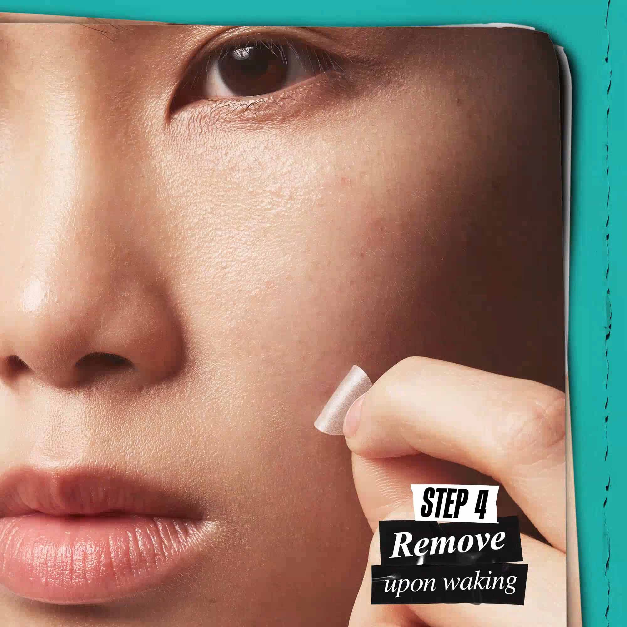 Truly Targeted Overnight Patch for Blemish-Prone Skin