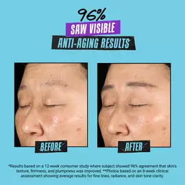 Super Multi-Corrective Oil-Free Soft Cream