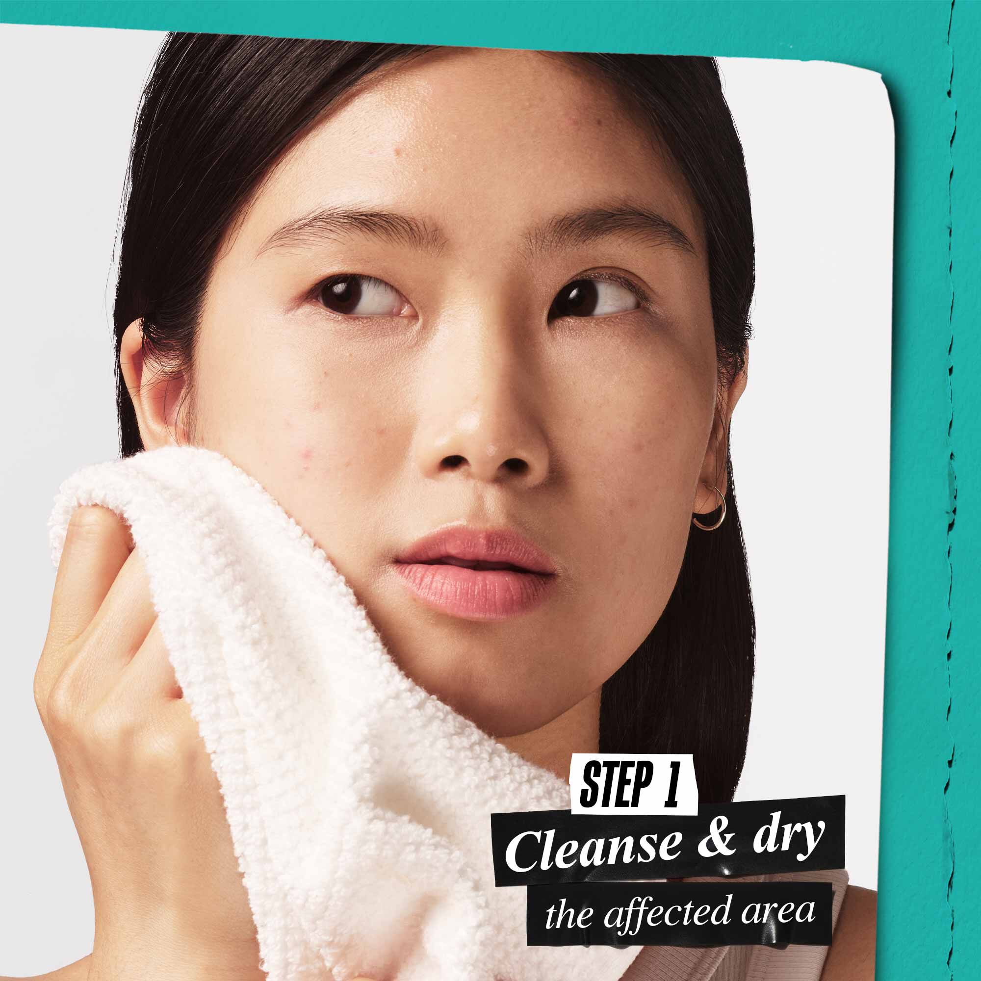 Truly Targeted Overnight Patch for Blemish-Prone Skin