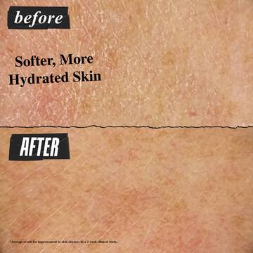 Softer, More Hydrated Skin