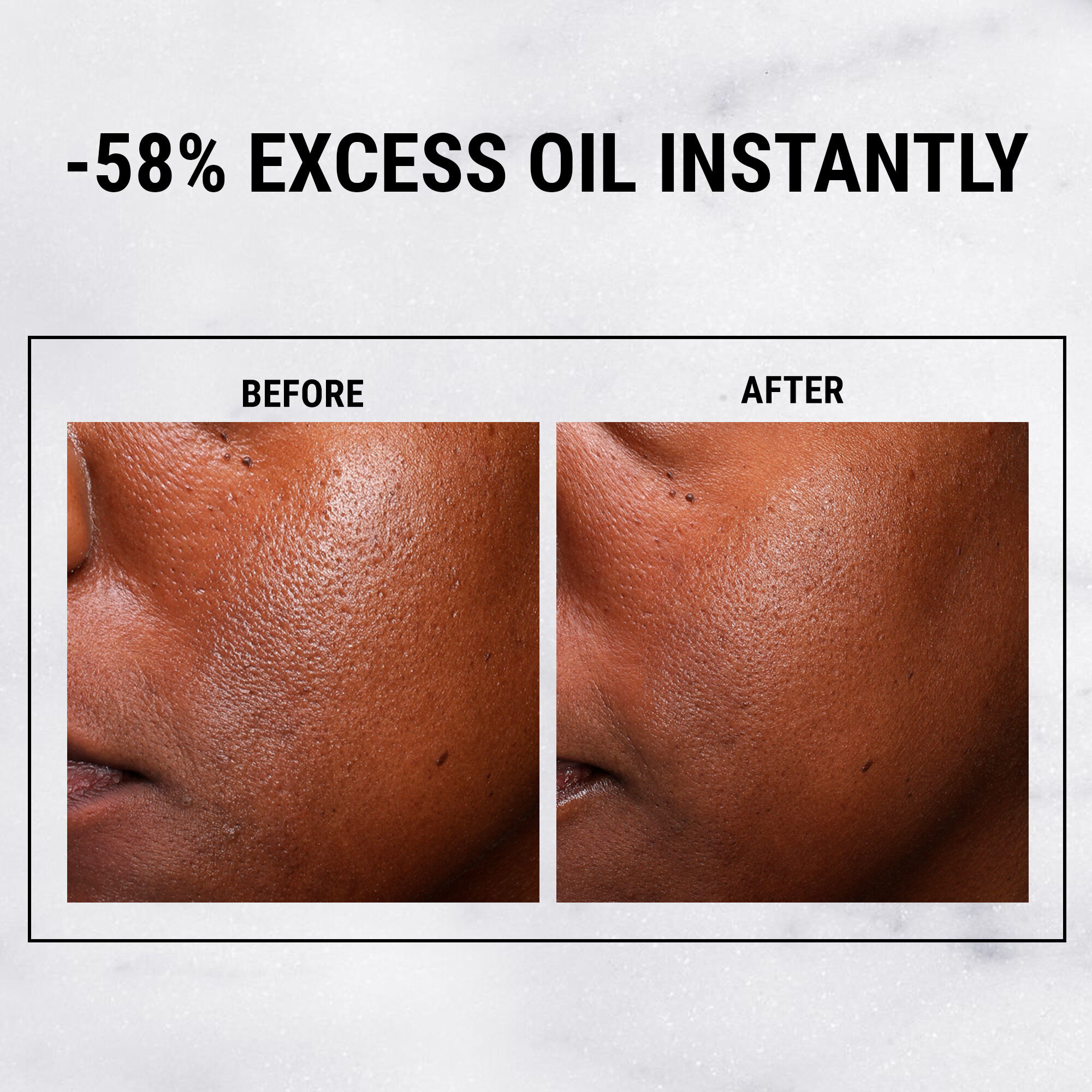 Ultra Pure High-Potency Serum 5% Niacinamide — Kiehl’s