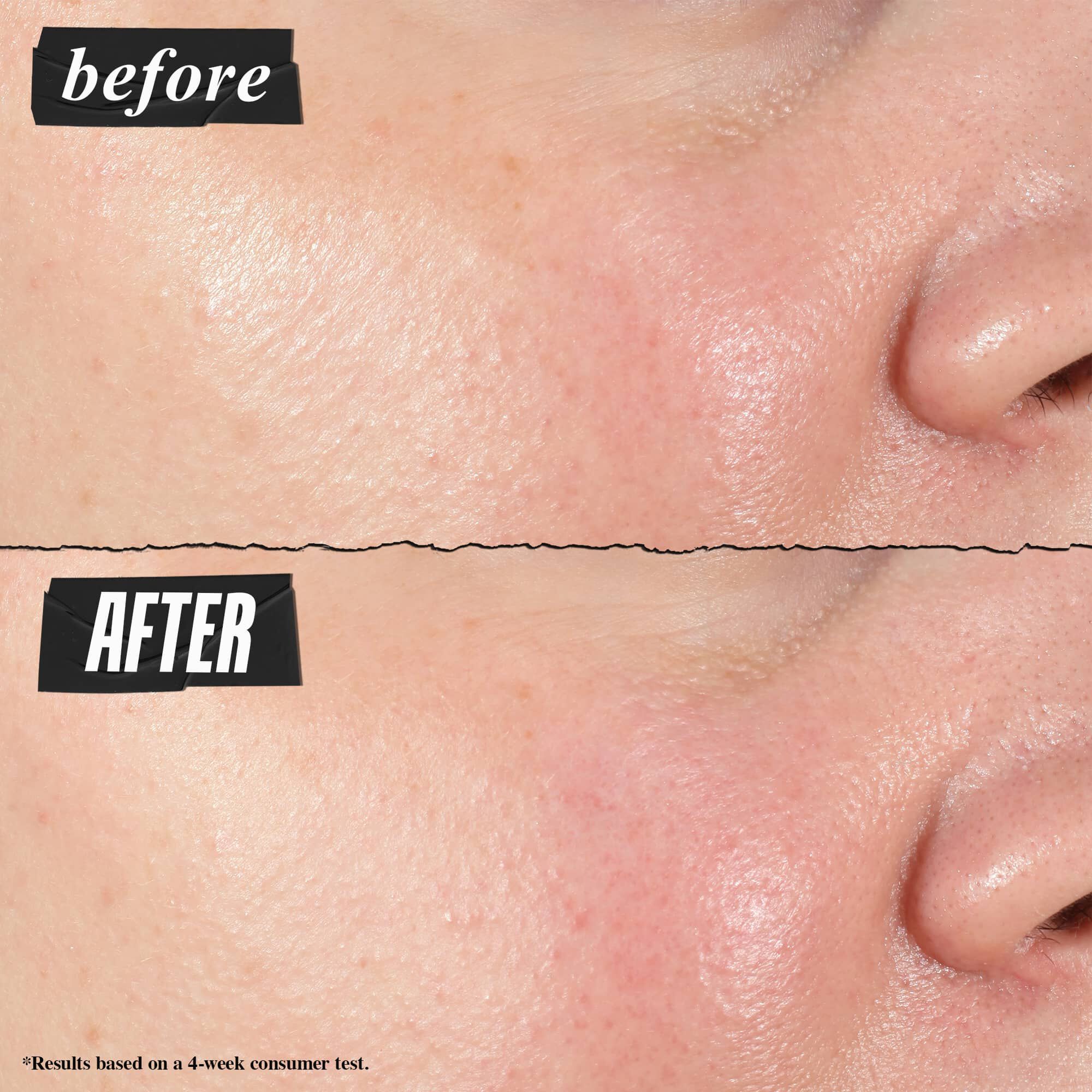 Serum Concentre Hydro-Repulpant