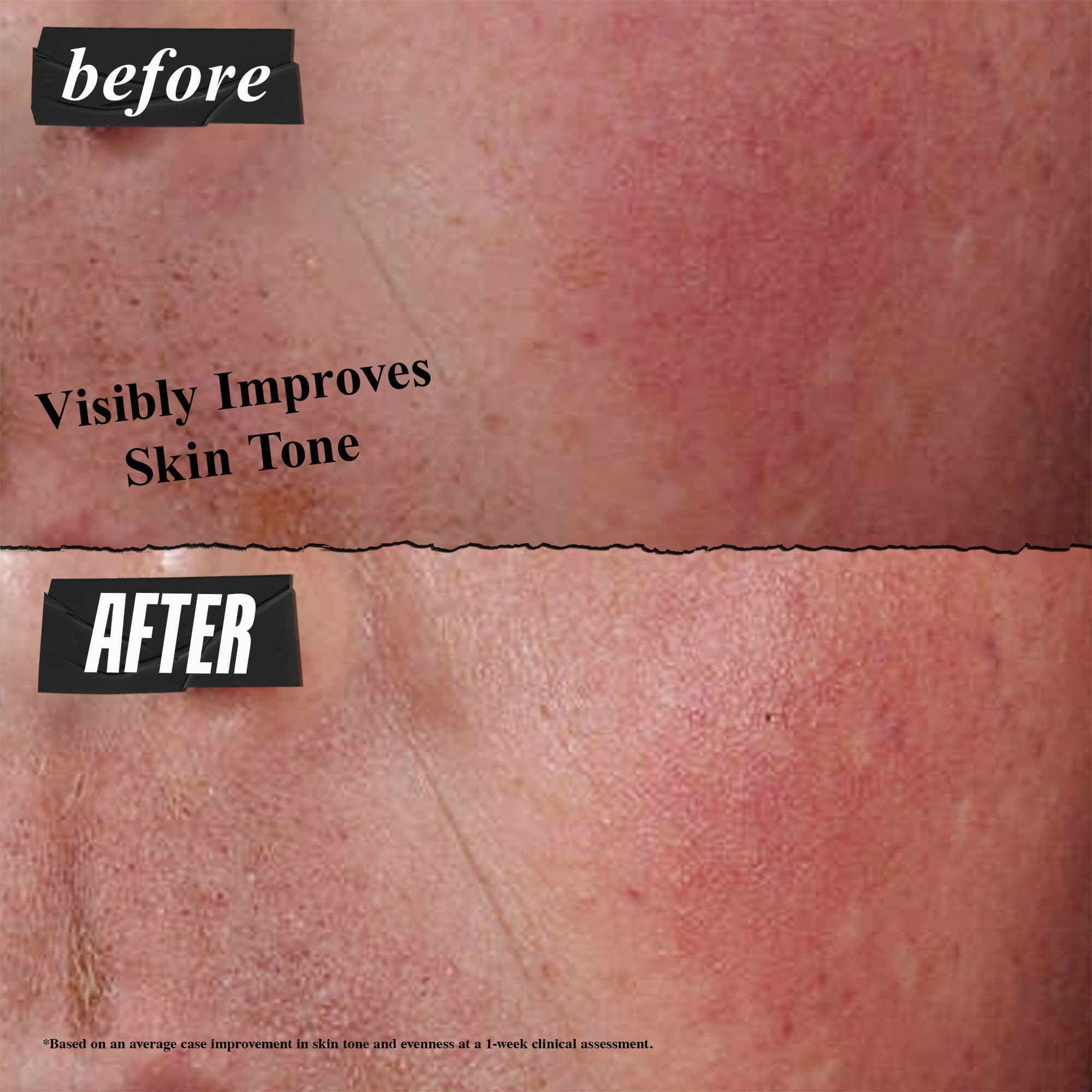 Ultra Facial Advanced Repair Barrier Cream