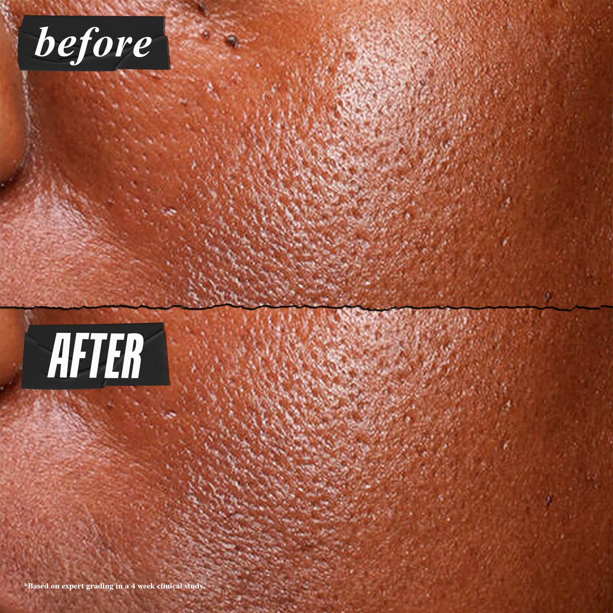 Serum ultra pur haute performance au Niacinamide 5,0 %