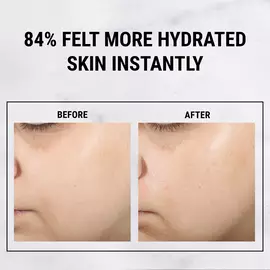 Ultra Pure High-Potency Serum 1.5% Hyaluronic Acid