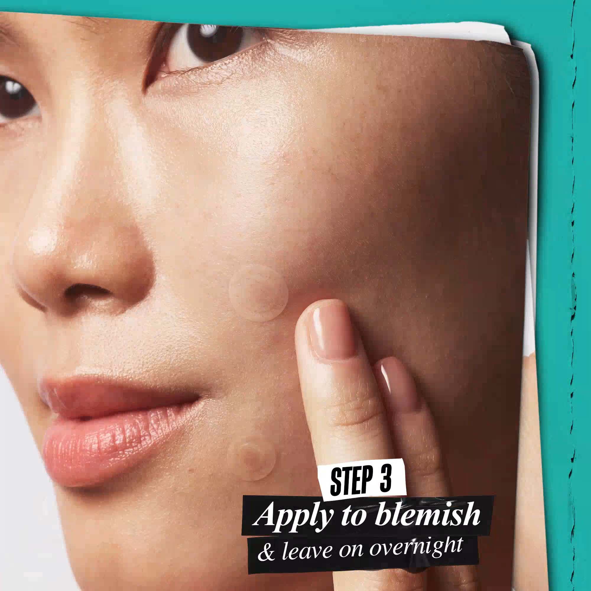 Truly Targeted Overnight Patch for Blemish-Prone Skin