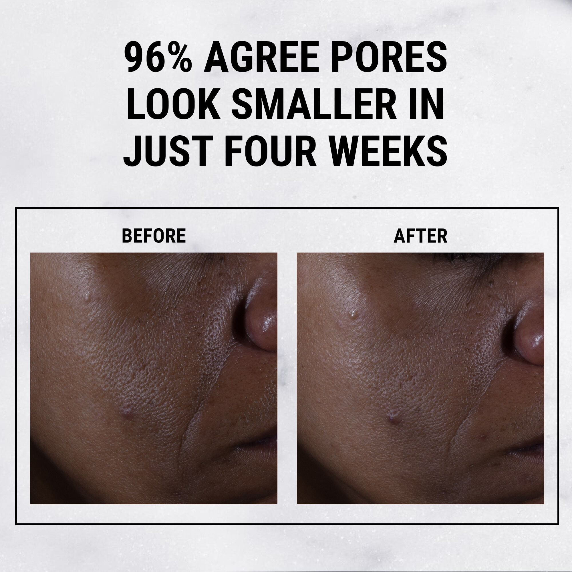 Ultra Pure High-Potency Serum 9.8% Glycolic Acid