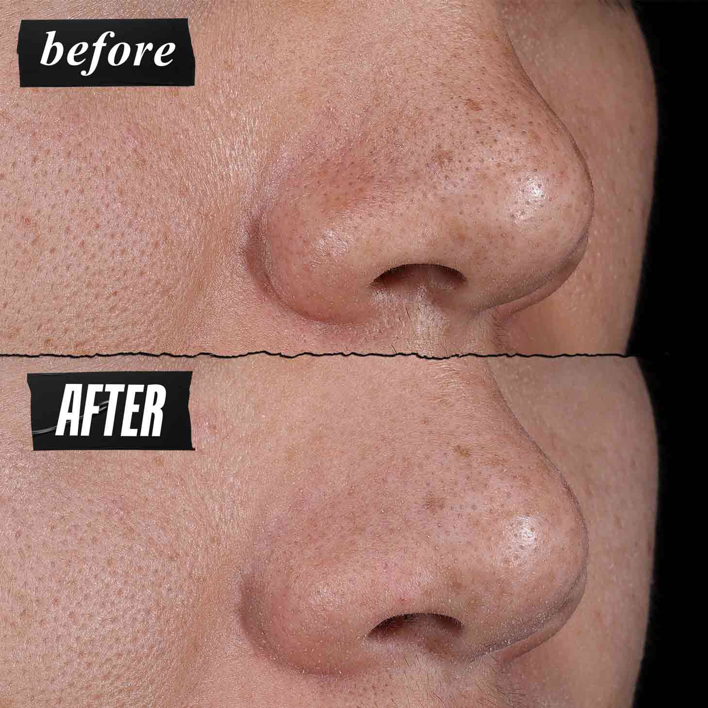 Masque desincrustant Rare Earth