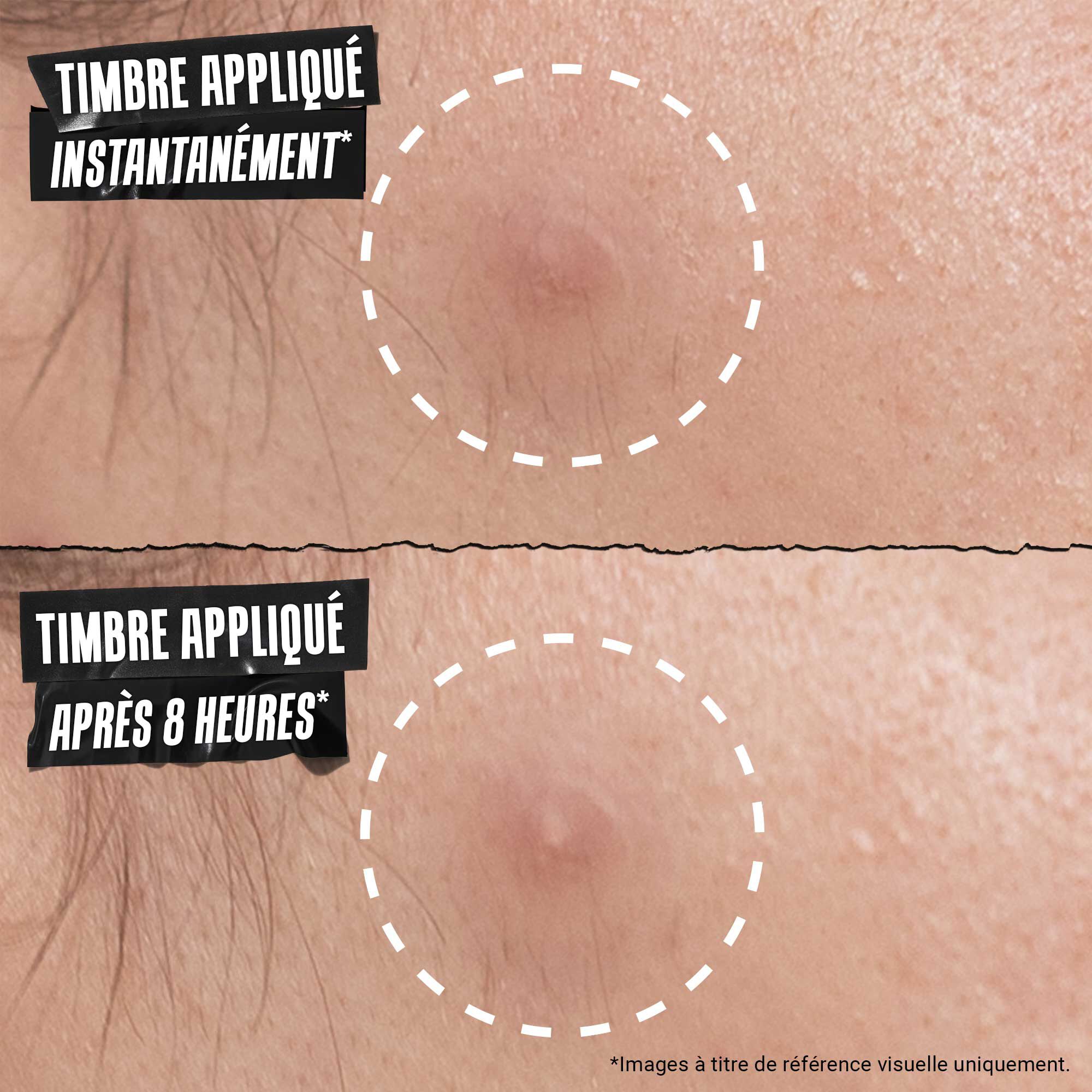 Timbre Nuit Cible Haute Precision pour Peau a Tendance Acneique
