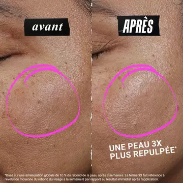 1cc* Serum Repulpant CollaShot