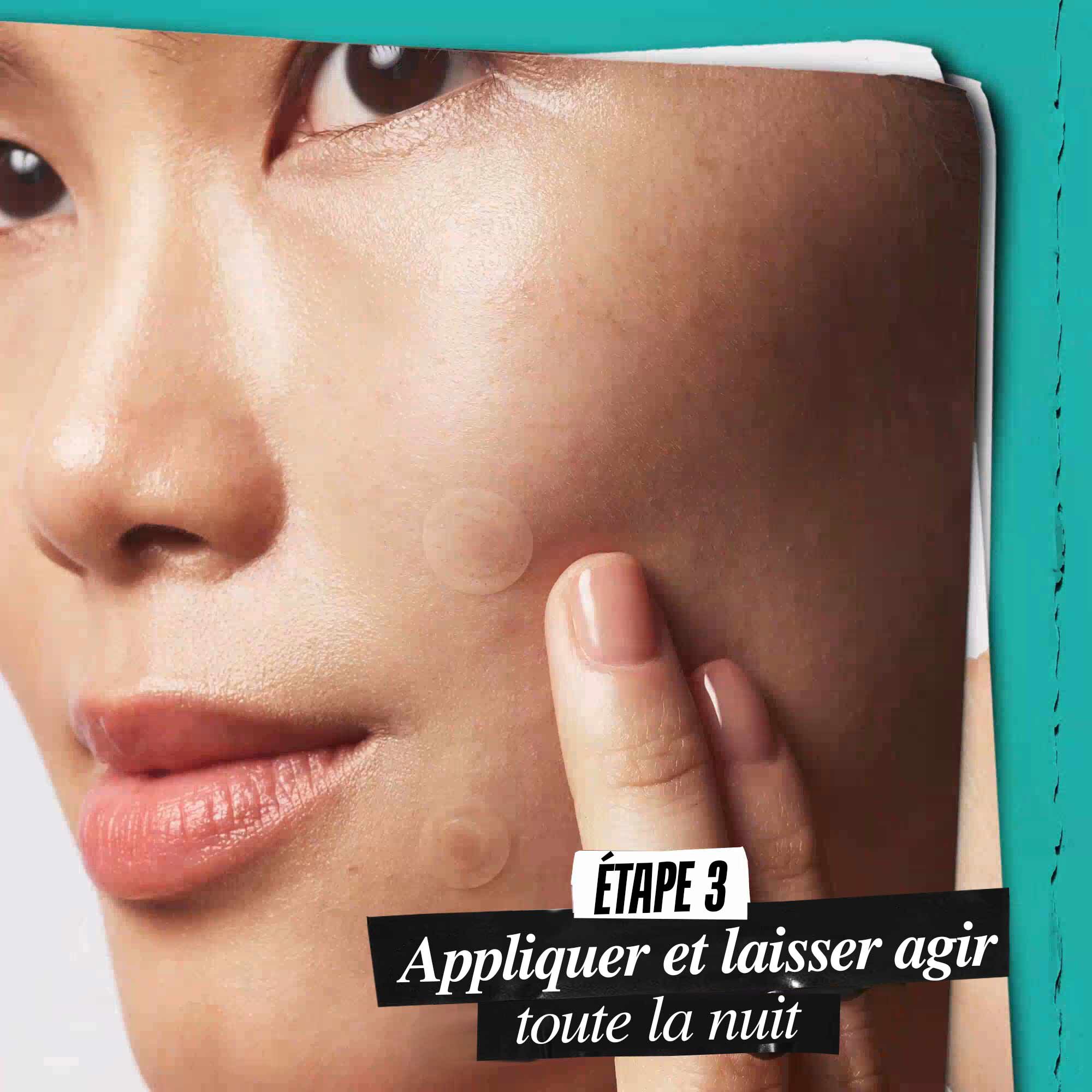 Timbre Nuit Cible Haute Precision pour Peau a Tendance Acneique